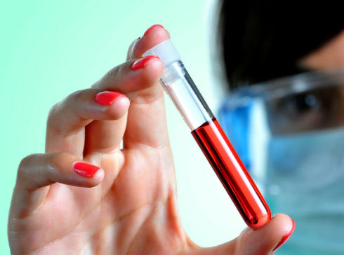 Как узнать уровень гематокрита в крови?